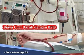 Proses Cuci Darah Menggunakan Prinsip